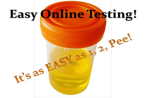 Picture of a urine sample